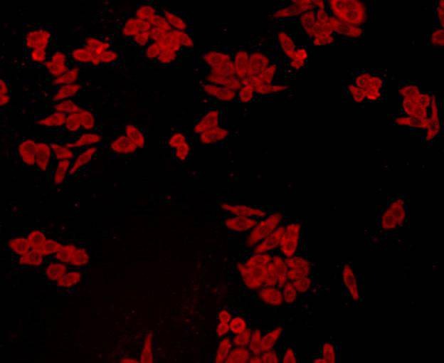 Anti-GPX1 Antibody (3M540)