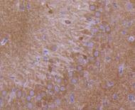 Anti-Glutamate receptor 1 Antibody (3G336)
