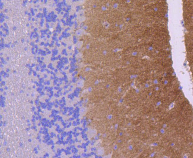 Anti-Glutamate receptor 1 Antibody (3G336)