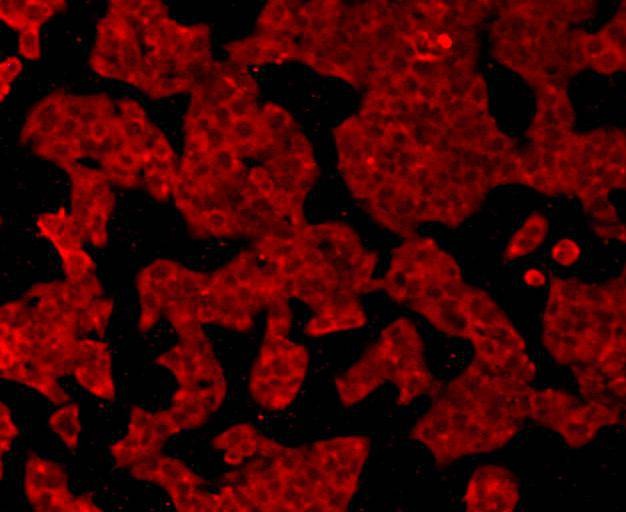 Anti-GPX1 Antibody (3M540)