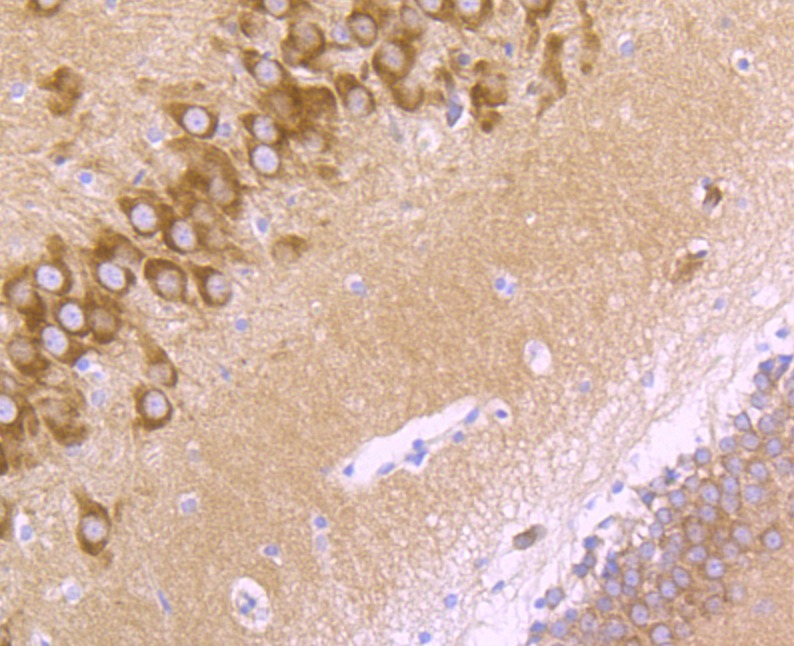 Anti-GRIA2 Antibody (8K502)