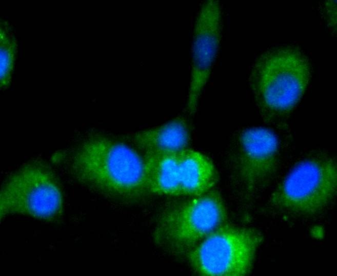 Anti-GAPDH Antibody (4W994)