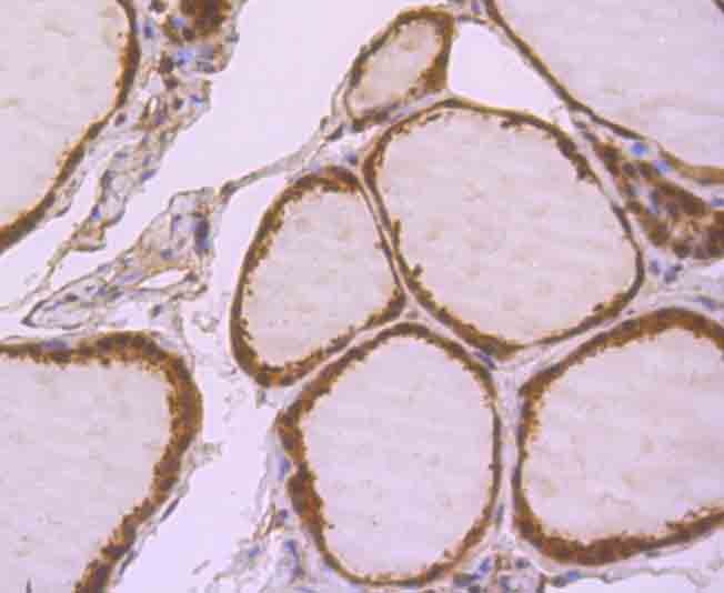 Anti-Lactoylglutathione lyase/GLO1 Antibody (8P849)