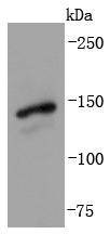 Anti-GLI1 Antibody (6E606)