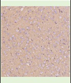 Anti-SLC2A1 Antibody (3P617)