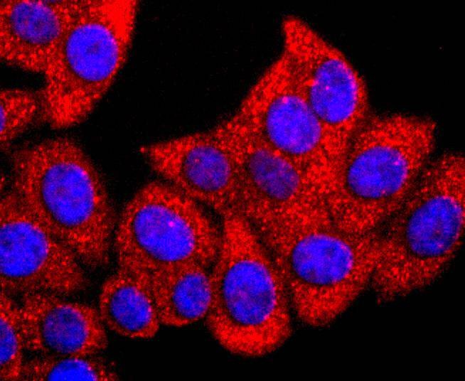Anti-GLI1 Antibody (6E606)