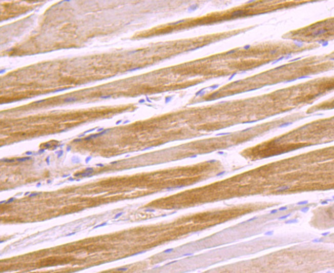 Anti-G6PD Antibody (4T578)