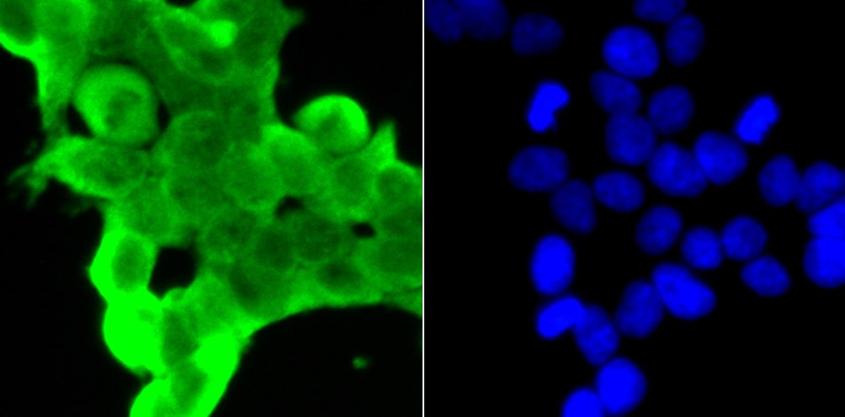 Anti-Lactoylglutathione lyase/GLO1 Antibody (8P849)