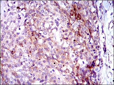 Anti-Osteoactivin/GPNMB Antibody (4G206)