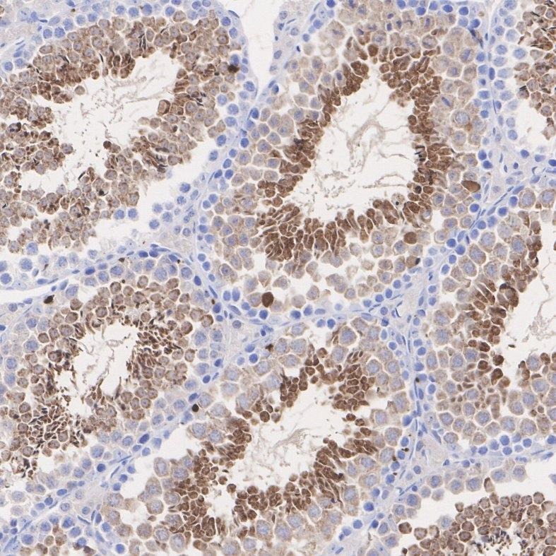 Anti-GPX4 Antibody (5M410)