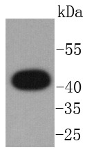 Anti-GPCR RDC1 Antibody (1C445)