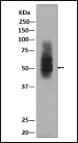 Anti-SLC2A1 Antibody (3P617)