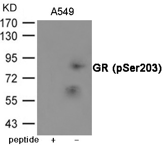 Anti-Phospho-NR3C1 (Ser203) Polyclonal Antibody