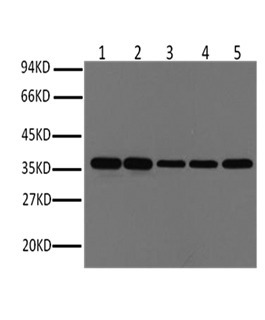 Anti-GAPDH Antibody (9X189)