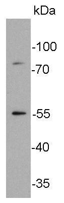 Anti-Glucose Transporter GLUT4 Antibody (9P565)
