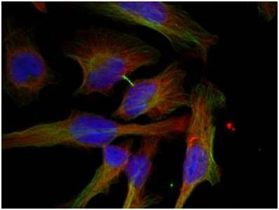 Anti-Phospho-GSK3B (Ser9) Polyclonal Antibody 2