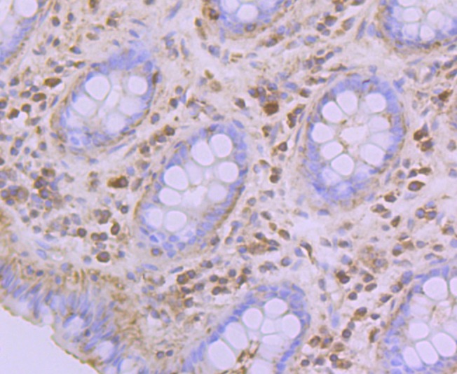 Anti-GPI Antibody (6K139)