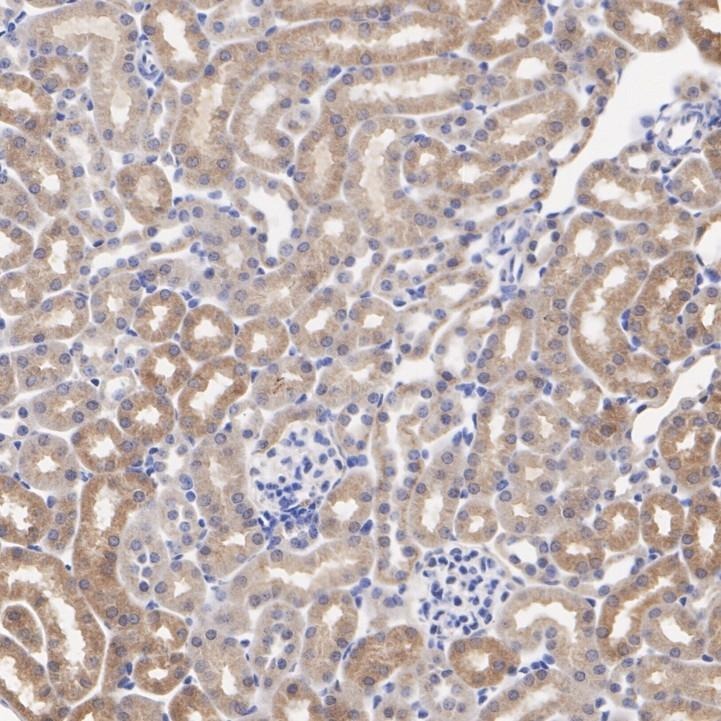 Anti-GPX4 Antibody (5M410)