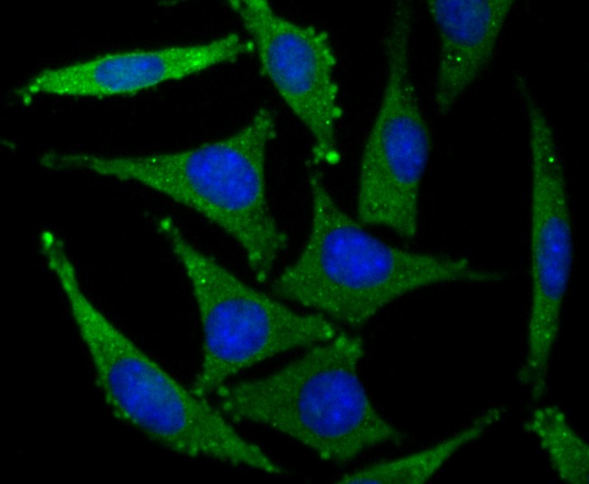 Anti-GRIA2 Antibody (8K502)