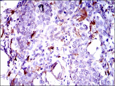 Anti-Osteoactivin/GPNMB Antibody (4G206)