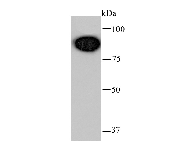 Anti-NR3C1 Antibody (1M615)