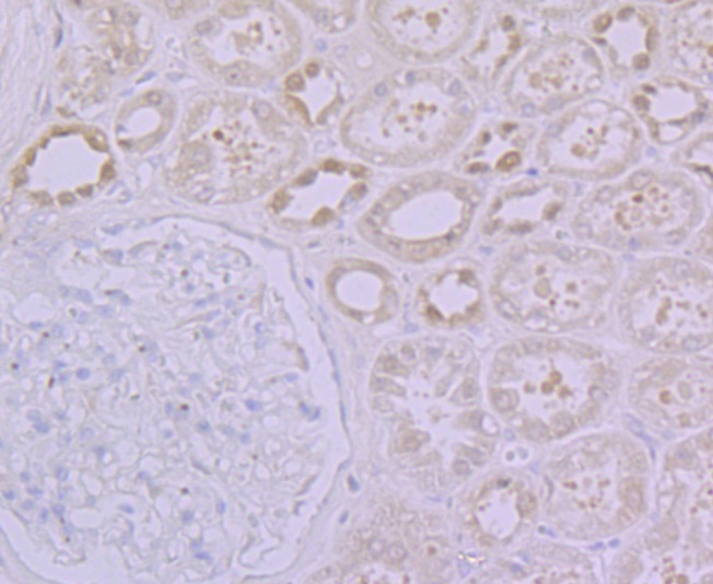 Anti-GPI Antibody (6K139)
