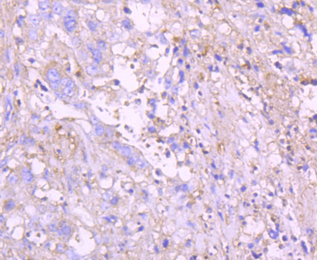 Anti-G6PD Antibody (4T578)