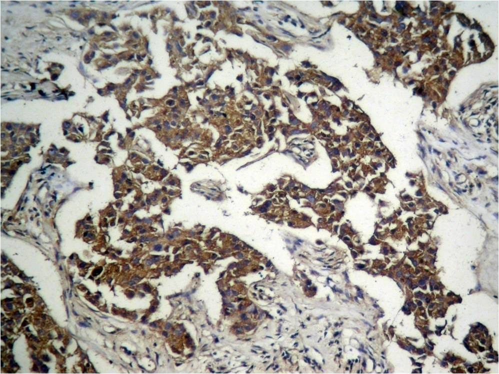 Anti-Phospho-GSK3B (Ser9) Polyclonal Antibody 2