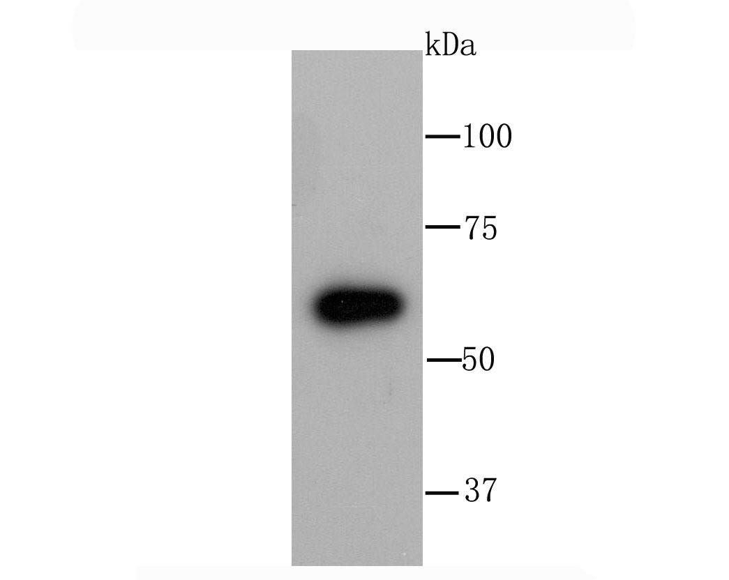 Anti-G6PD Antibody (4T578)