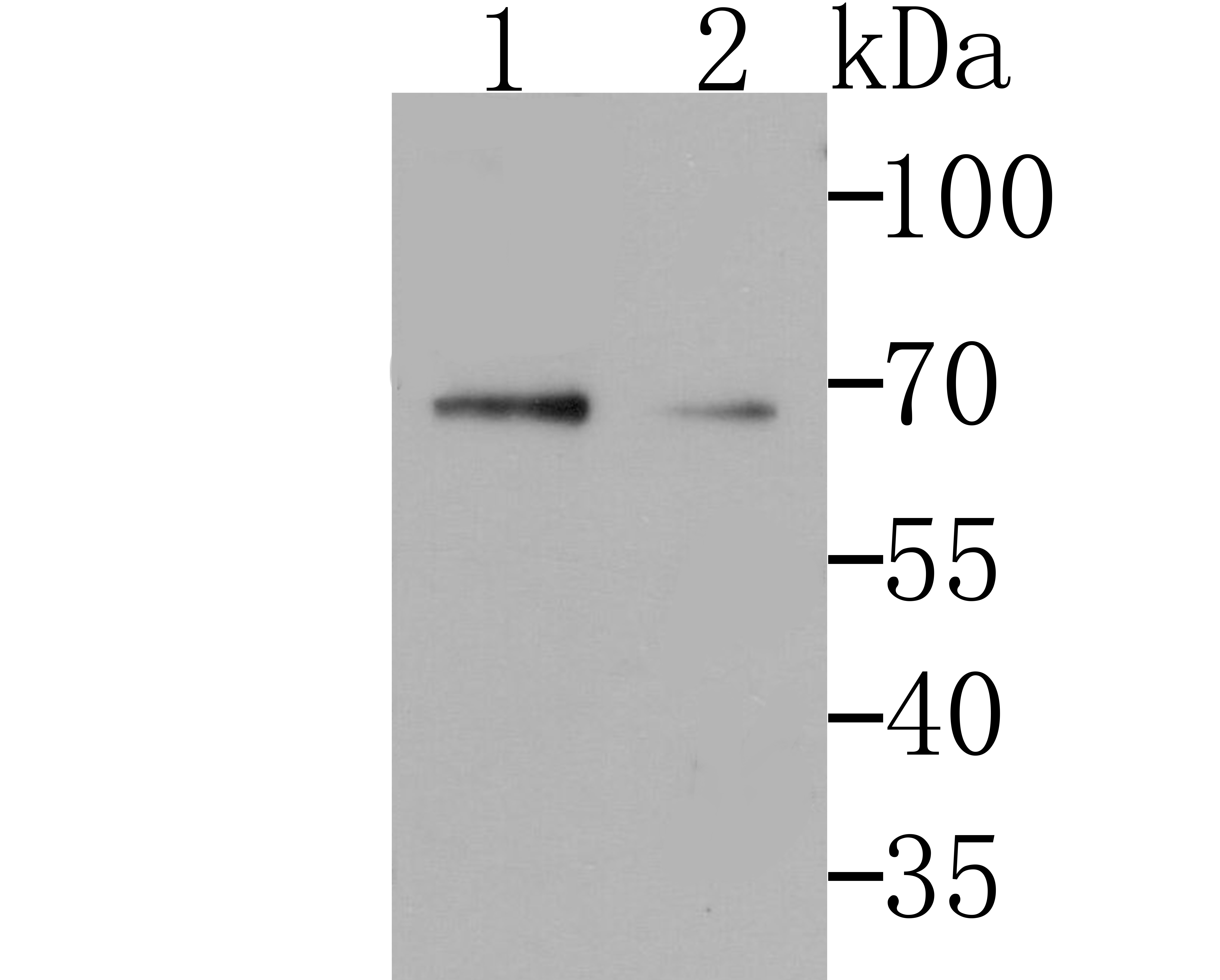 Anti-GRASP65 Antibody (9N637)