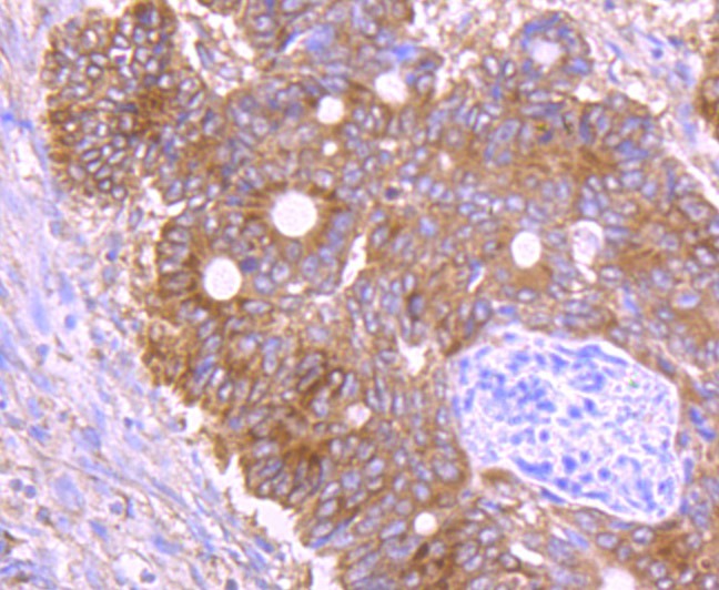 Anti-GRASP65 Antibody (9N637)
