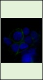 Anti-SLC2A1 Antibody (3P617)