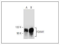 Anti-FOxM1 Antibody (6G924)