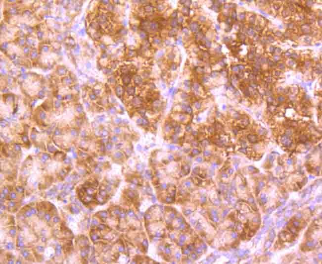 Anti-GABARAP Antibody (1D418)