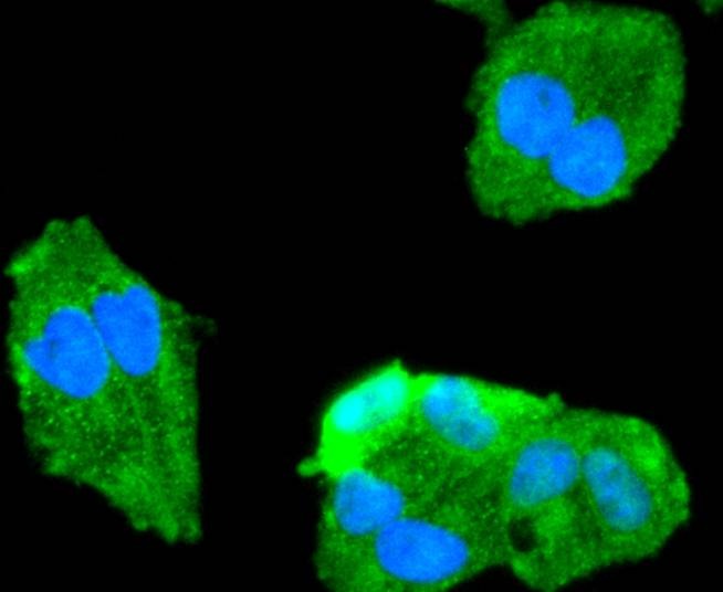 Anti-FOXO1 Antibody (6M554)