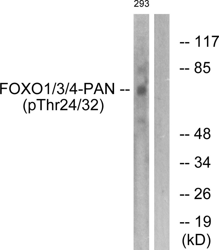 Anti-Phospho-FOXO1/3/4 (Thr24/32) Polyclonal Antibody