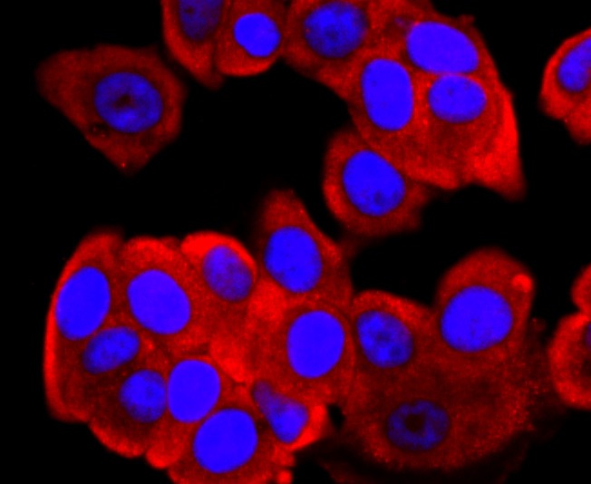 Anti-FGFR3 Antibody (4S518)