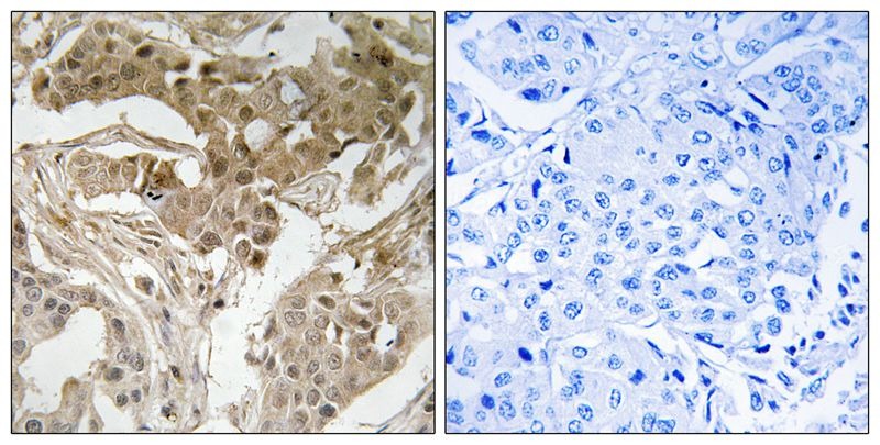 Anti-Phospho-FOS (Thr232) Polyclonal Antibody