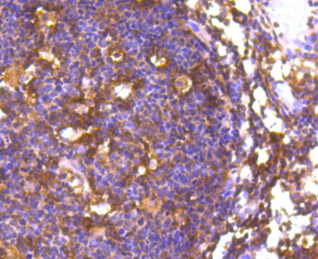 Anti-FOXO1 Antibody (6M554)