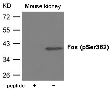 Anti-Phospho-FOS (Ser362) Polyclonal Antibody