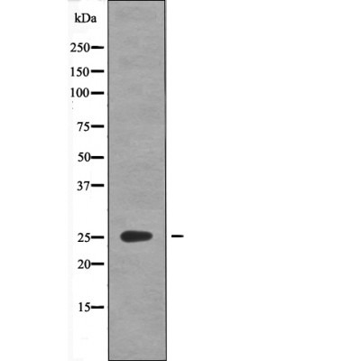 Anti-Phospho-GAIP (Ser151) Polyclonal Antibody