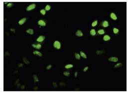 Anti-FOXF2 Antibody (8Y605)