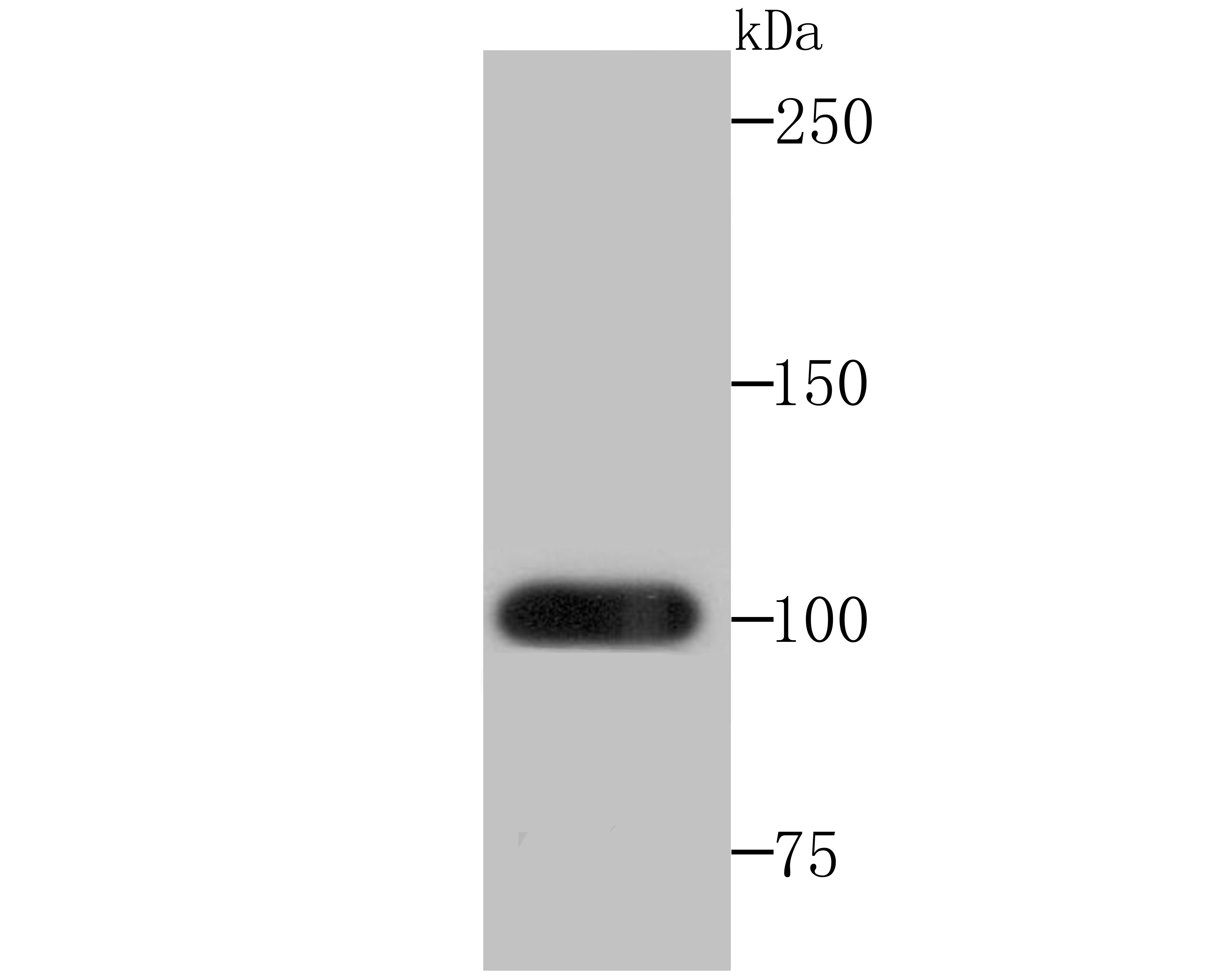 Anti-Frizzled-8 Antibody (5A651)