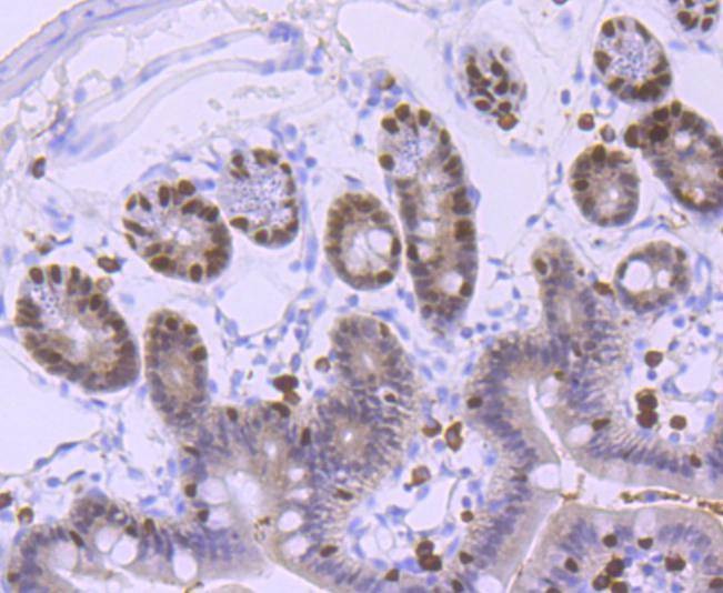 Anti-FOXA1 Antibody (5M374)