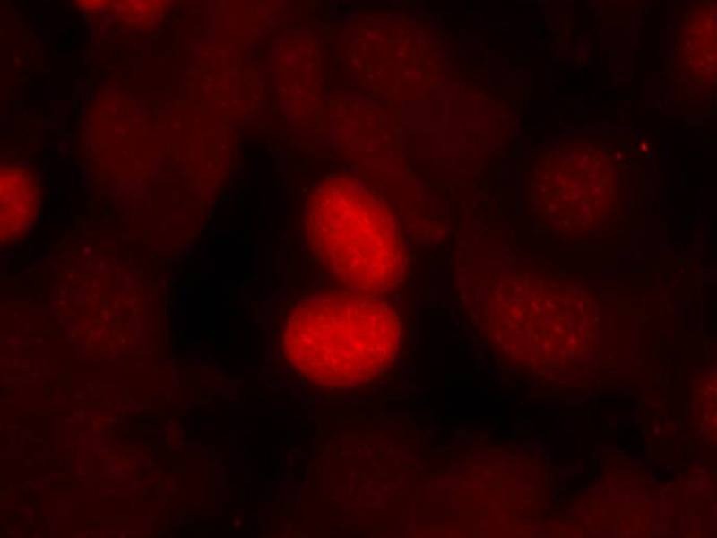 Anti-Phospho-FKHR (Ser256) Polyclonal Antibody