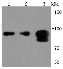 Anti-FOXP1 Antibody (1G20)