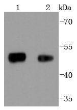 Anti-FOXA1 Antibody (5M374)