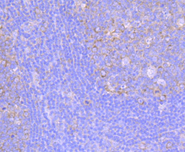 Anti-FMR1 Antibody (9X925)