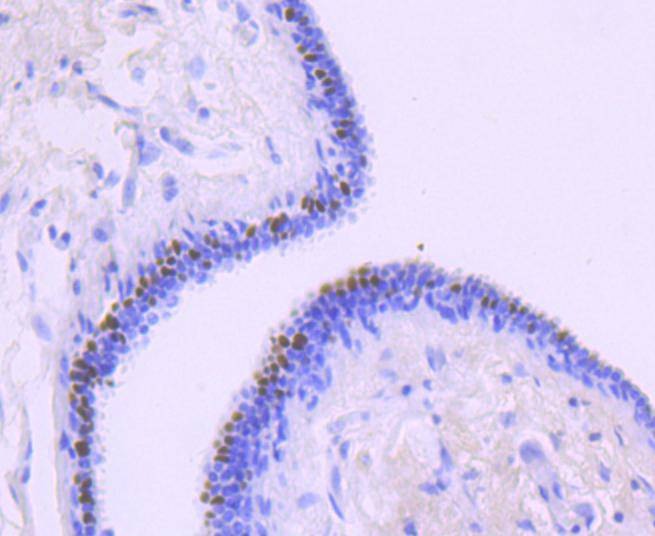Anti-FOXA1 Antibody (5M374)