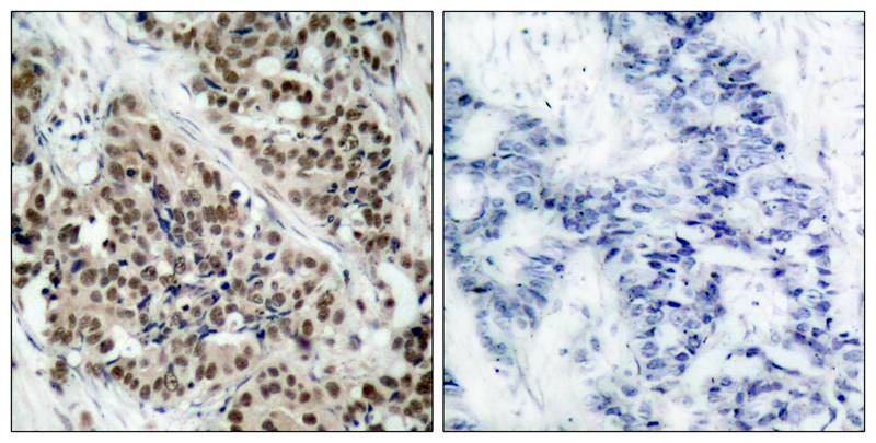 Anti-Phospho-FKHR (Ser256) Polyclonal Antibody